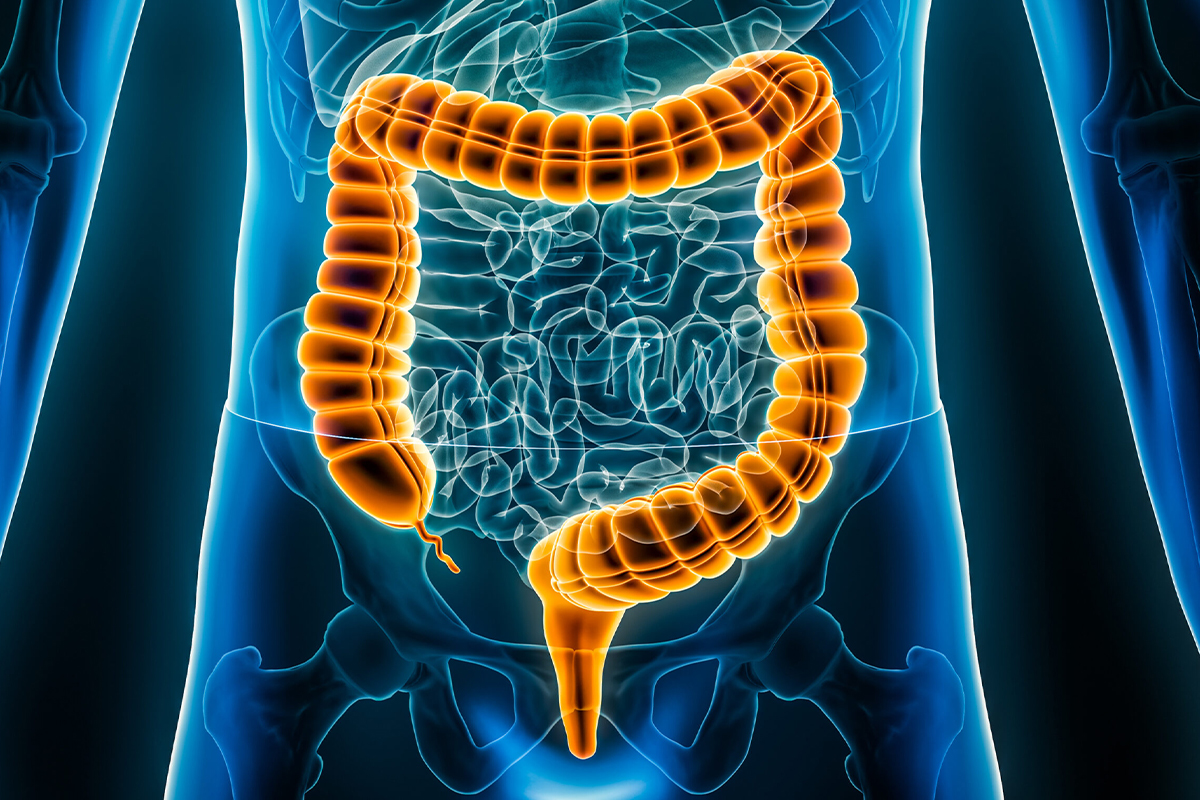 What is Faecal Microbiota Transplantation