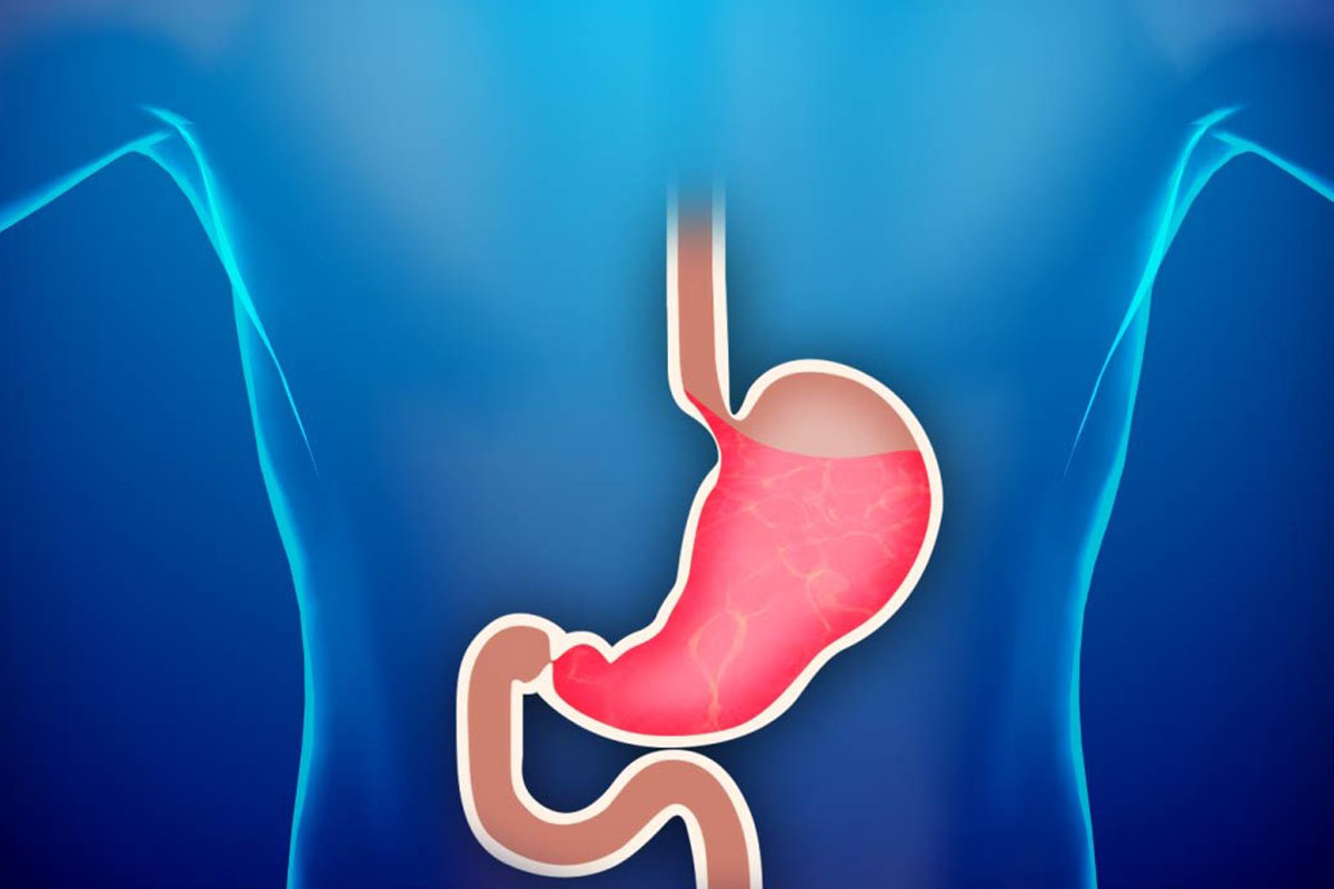 Reflü Alkalen Reflü Gastrit Tedavisi 2025 | Doç.Dr. Murat Kanlıöz